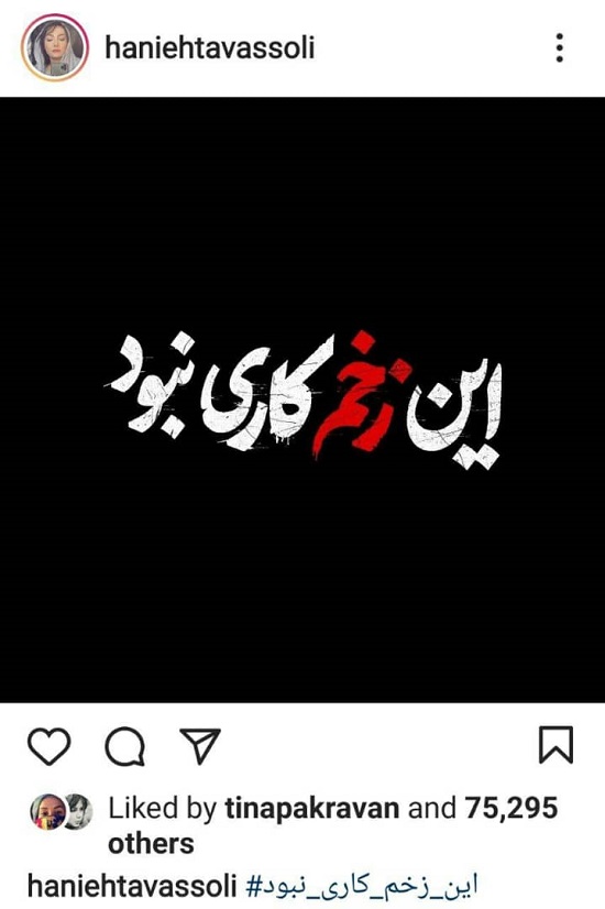 واکنش جدید هانیه توسلی به سانسور «زخم کاری»