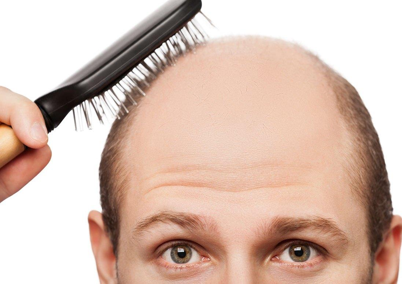 ریزش چند تار مو در طول روز طبیعی است؟