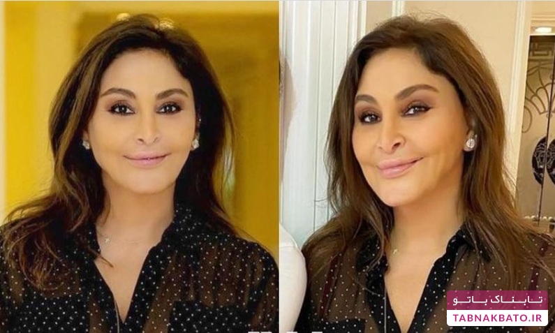 عکس‌های خواننده معرتف قبل و بعد از عمل زیبایی