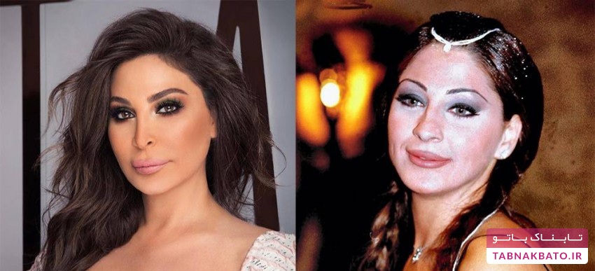 عکس‌های خواننده معرتف قبل و بعد از عمل زیبایی