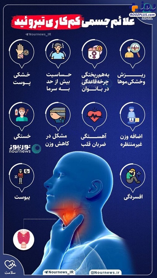 اینفوگرافیك/ علائم جسمی كم كاری تیروئید را بشناسید