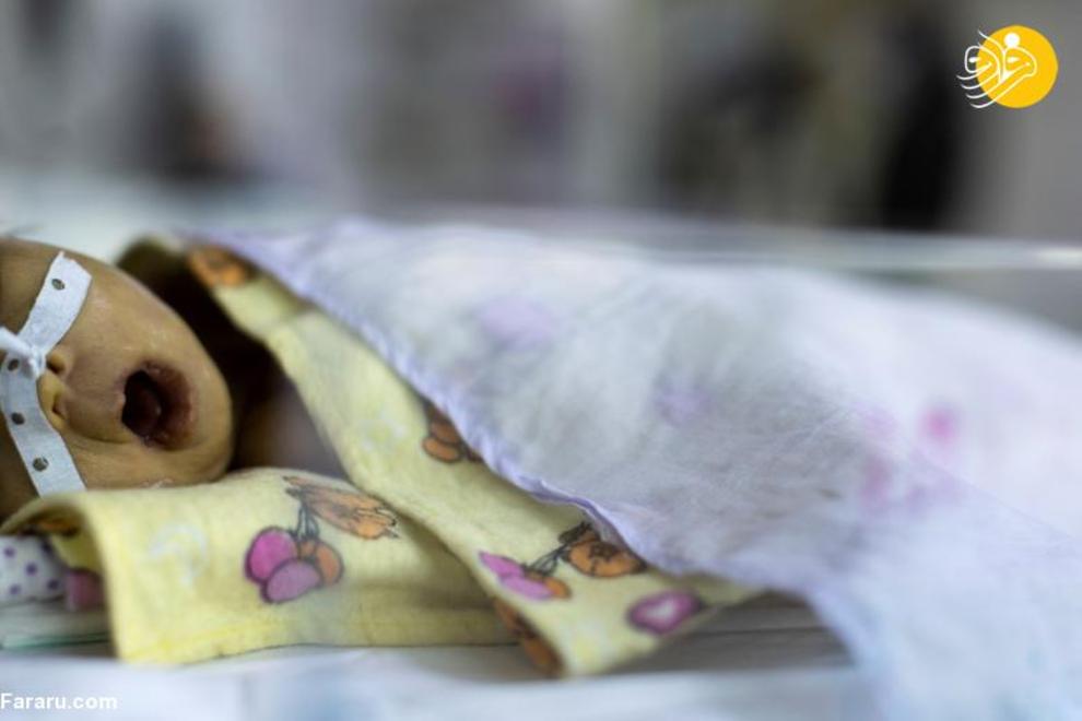 وضعیت آشفته بیمارستان‌های افغانستان با آمدن طالبان + عکس