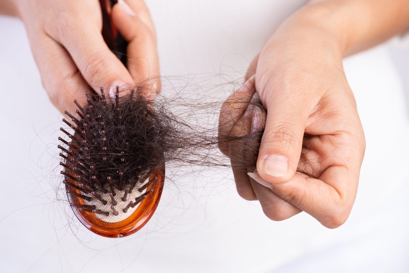 5 بیماری که باعث ریزش مو می شود