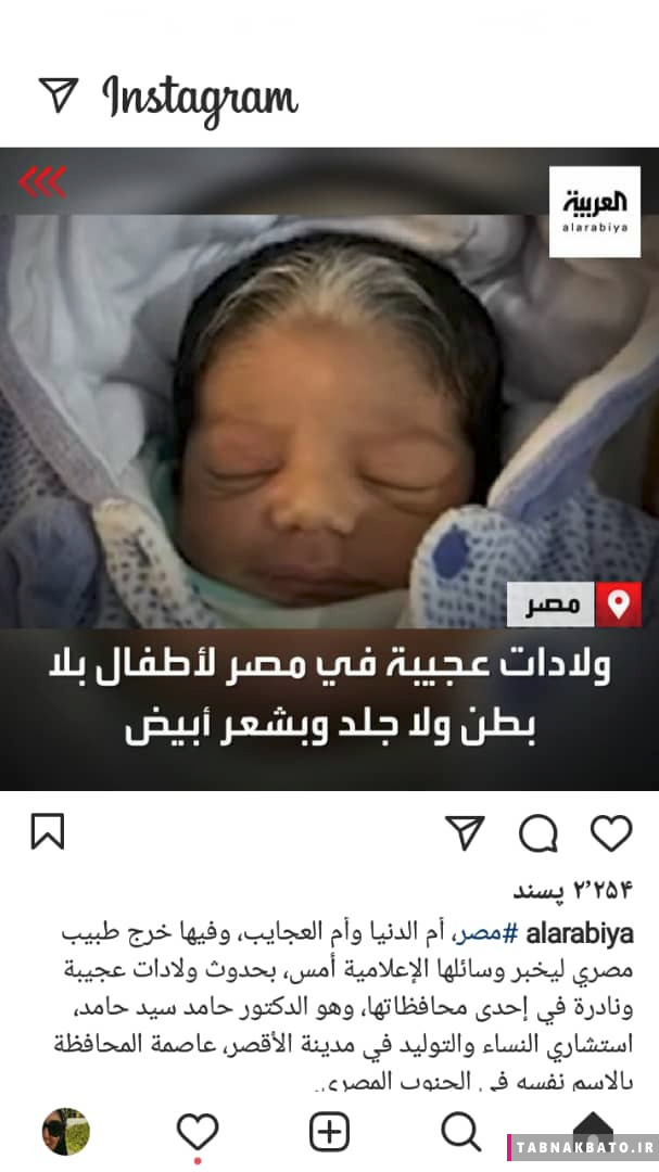 تولد نوزادانی عجیب در مصر