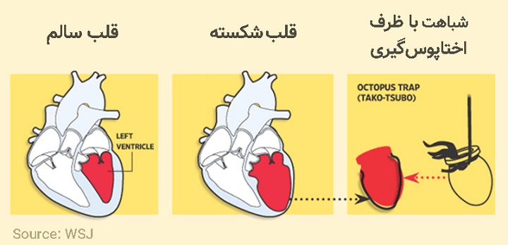 از «سندرم قلب شکسته» چه می‌دانید؟+ نشانه‌ها و علل
