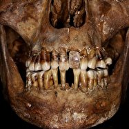 راز مبتکرانه یک اشراف‌زاده قرن هفدهمی برای حفظ دندان‌هایش