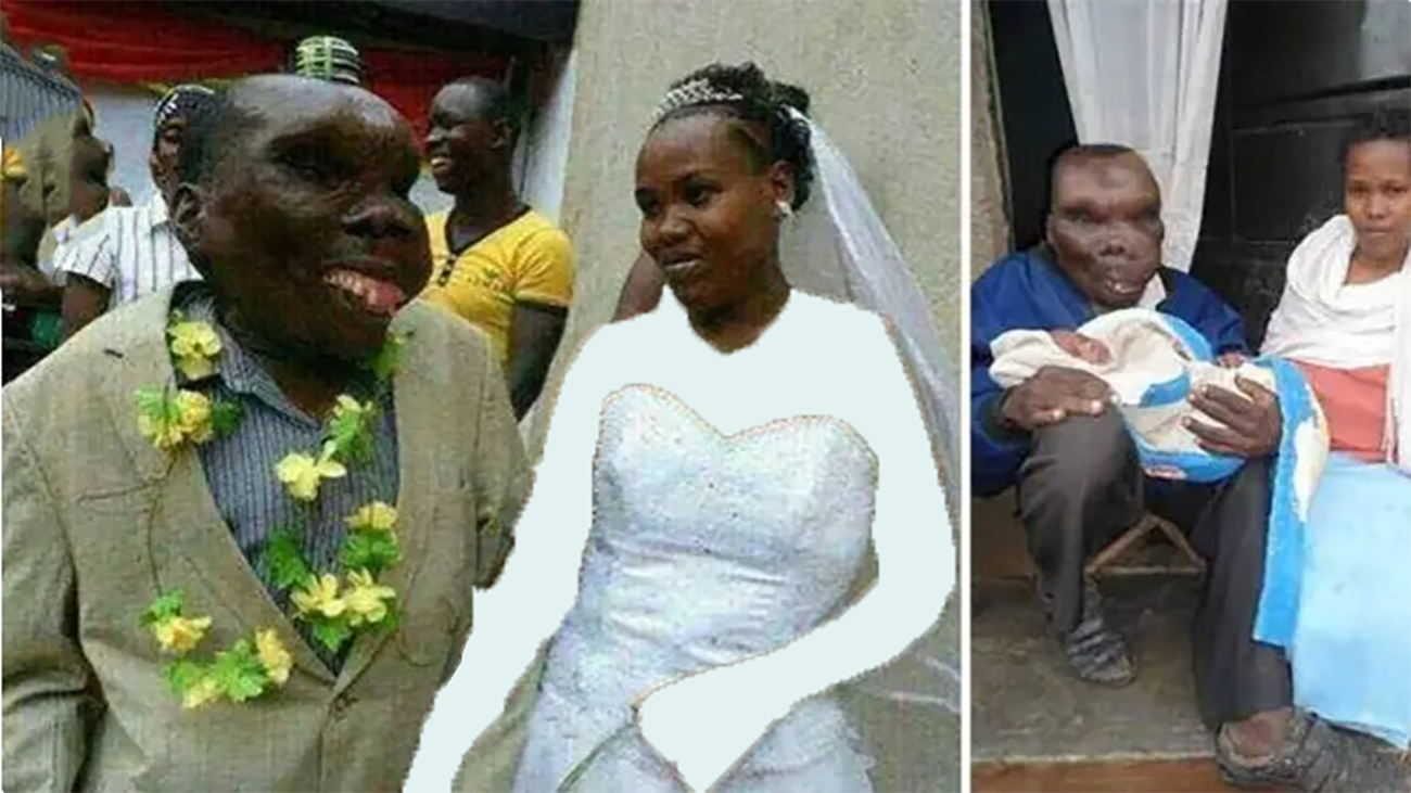 عکسی از زشت‌ترین مرد اوگاندا که ازدواج کرد!