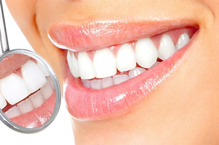 سفید کردن دندان‌ها؛ از روش‌های درمانی تا راه‌حل‌های خانگی(فرارو)