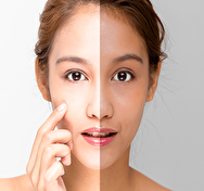 روش های طبیعی برای روشن کردن پوست صورت
