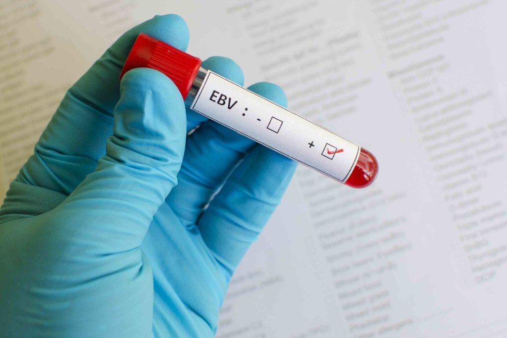 ویروس اپشتین-بار چیست و چقدر خطرناک است؟