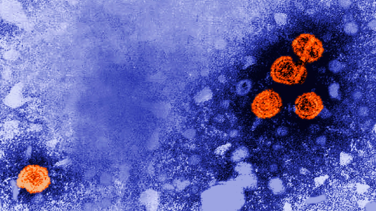 ویروس کبدی جدید چیست؟ هپاتیتی که گویا سوغات دوران پساکرونا برای کودکان است