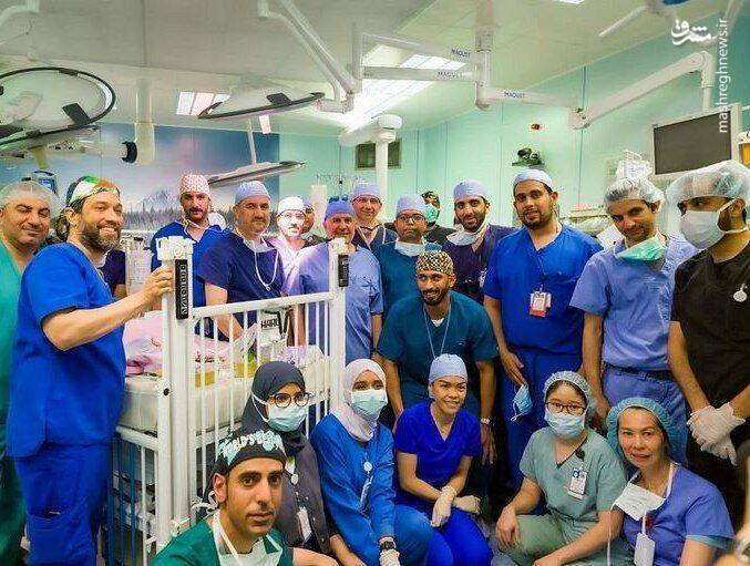 جداسازی دوقلوهای یمنی پس از ۱۵ ساعت عمل جراحی