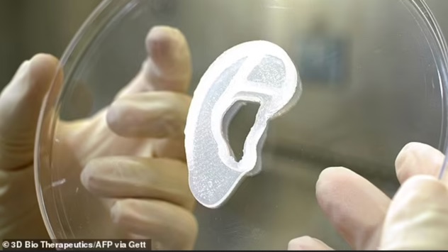 یک زن ۲۰ ساله با یک گوش خارجی جدید که توسط چاپ سه‌بعدی از سلول‌های خودش ساخته شده