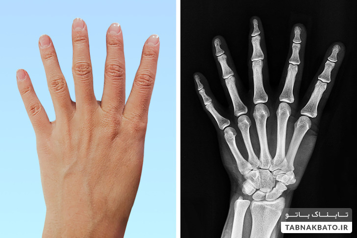 7 جهش جالب که تنها تعداد انگشت شماری از مردم دنیا آن را دارا هستند
