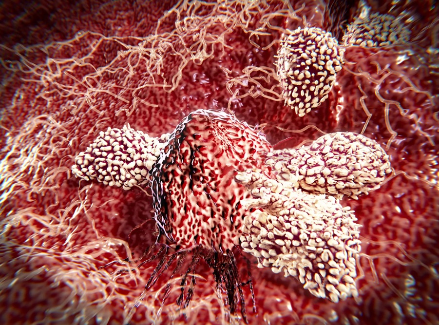 این تقویت‌کننده ایمونوتراپی ۱۰ هزار برابر بیشتر سلول‌های ضد سرطان تولید می‌کند: سلول‌های مهندسی شده T تقویت‌شده با IL-۷
