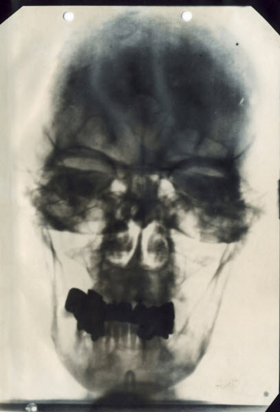 مروری بر اشیای نادر و شگفت‌انگیز کتابخانه ملی پزشکی آمریکا: از عکس اشعه ایکس سر هیتلر تا تصاویر آناتومیک یک طبیب ایرانی