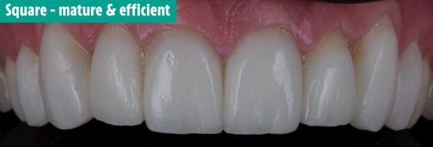 دندان های شما در مورد شخصیت تان چه می گویند؟