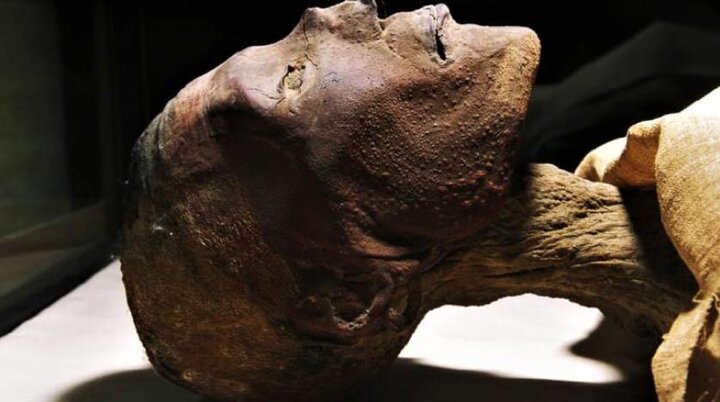 یافته های عجیب / فرعون مصر به آبله میمون مبتلا بوده است