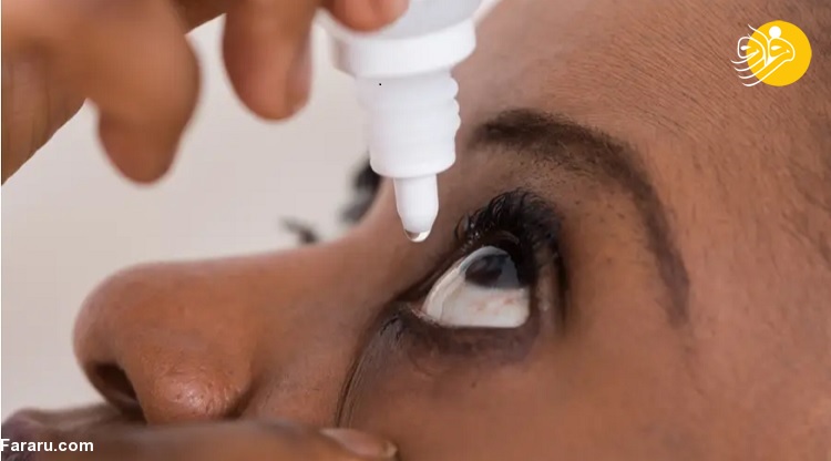 همه چیز درباره آلرژی چشم؛ علائم و درمان