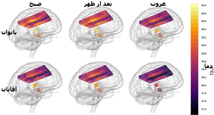 مغز زنان داغ‌تر است! / یک کشف جالب در نقشه ۴ بعدی دمای مغز