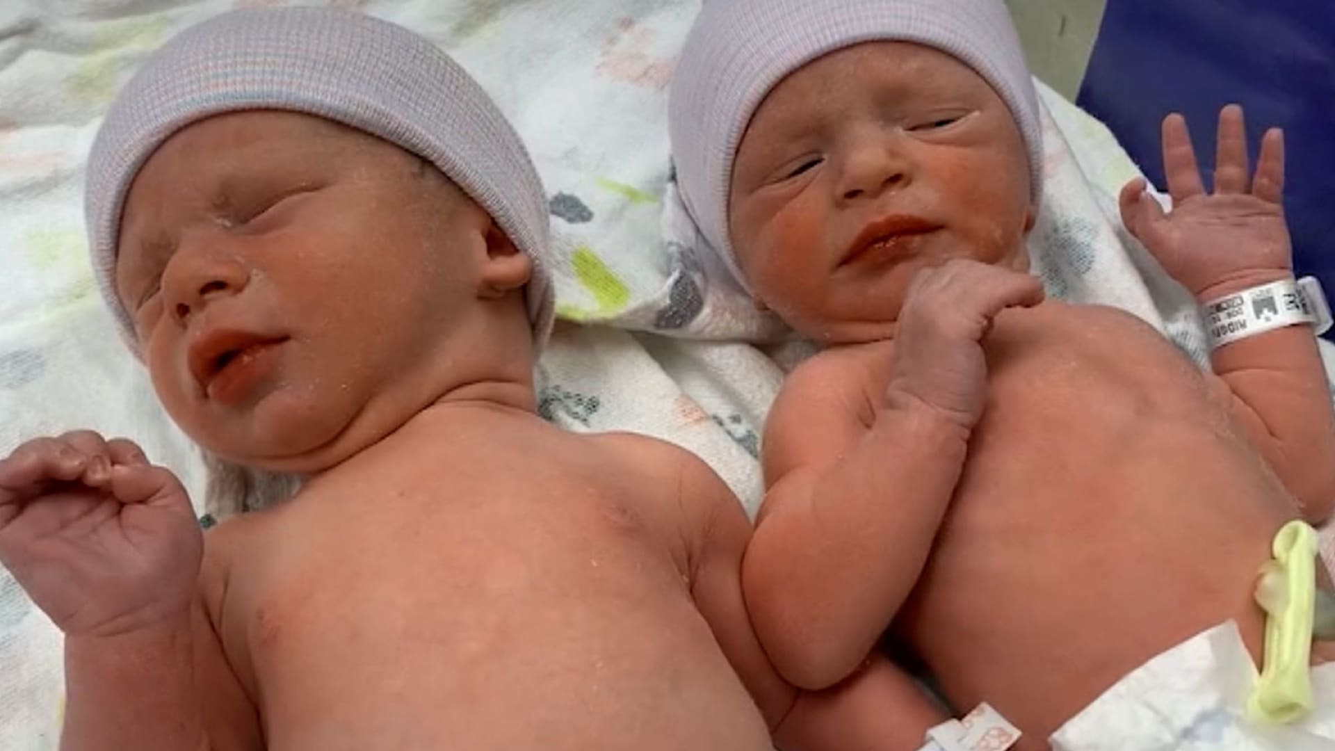 تولد دو نوزاد از نطفه‌هایی که ۳۰سال منجمد بودند