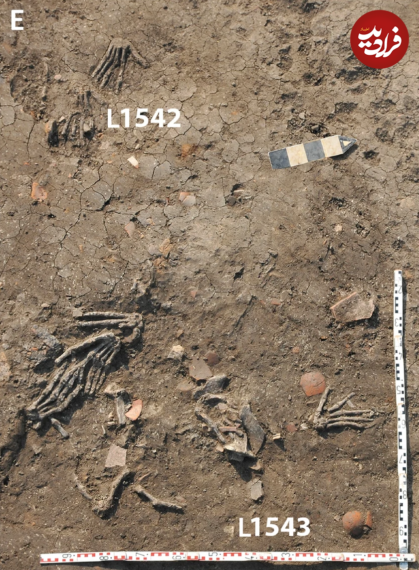 راز دست‌هایی که ۳۵۰۰سال پیش قطع شدند