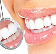 سفید کردن دندان‌ها؛ از روش‌های درمانی تا راه‌حل‌های خانگی