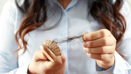 دلایل ریزش موی زنان بالای ۴۰ سال (بیتوته)