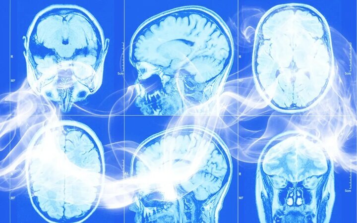 دانشمندان می‌گویند سیگار کشیدن مغز انسان را نابود می‌کند (زومیت)