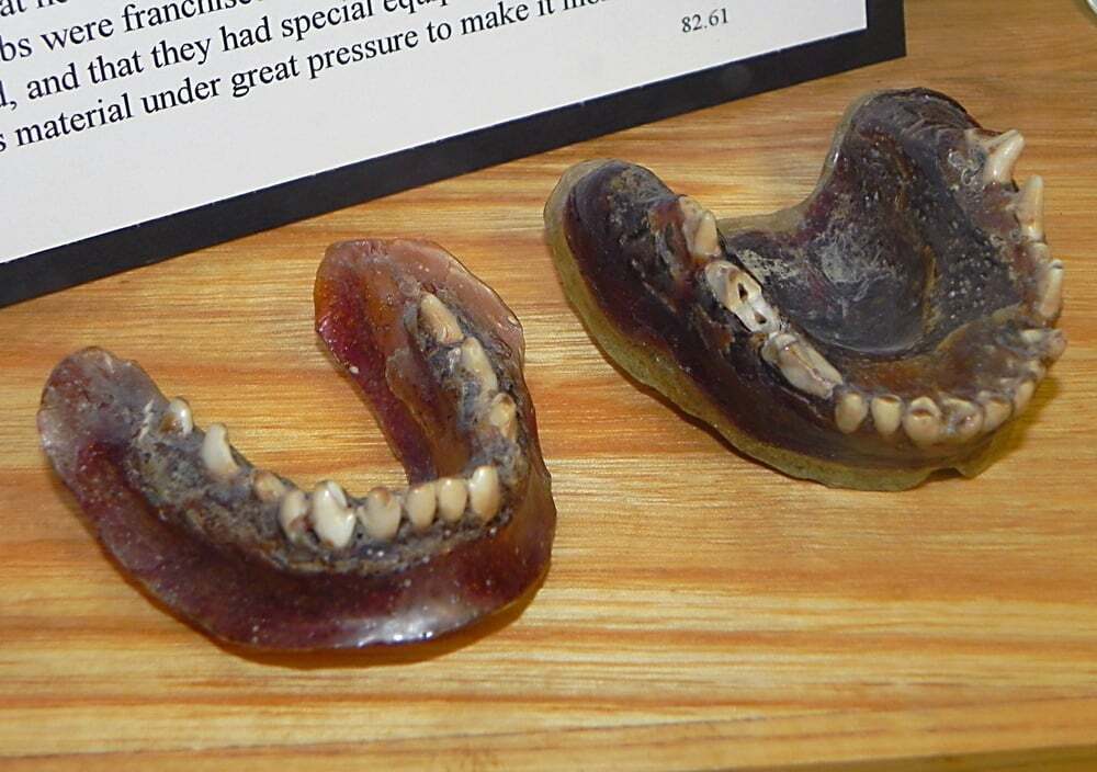 تصویری از متفاوت‌ترین دندان مصنوعی جهان