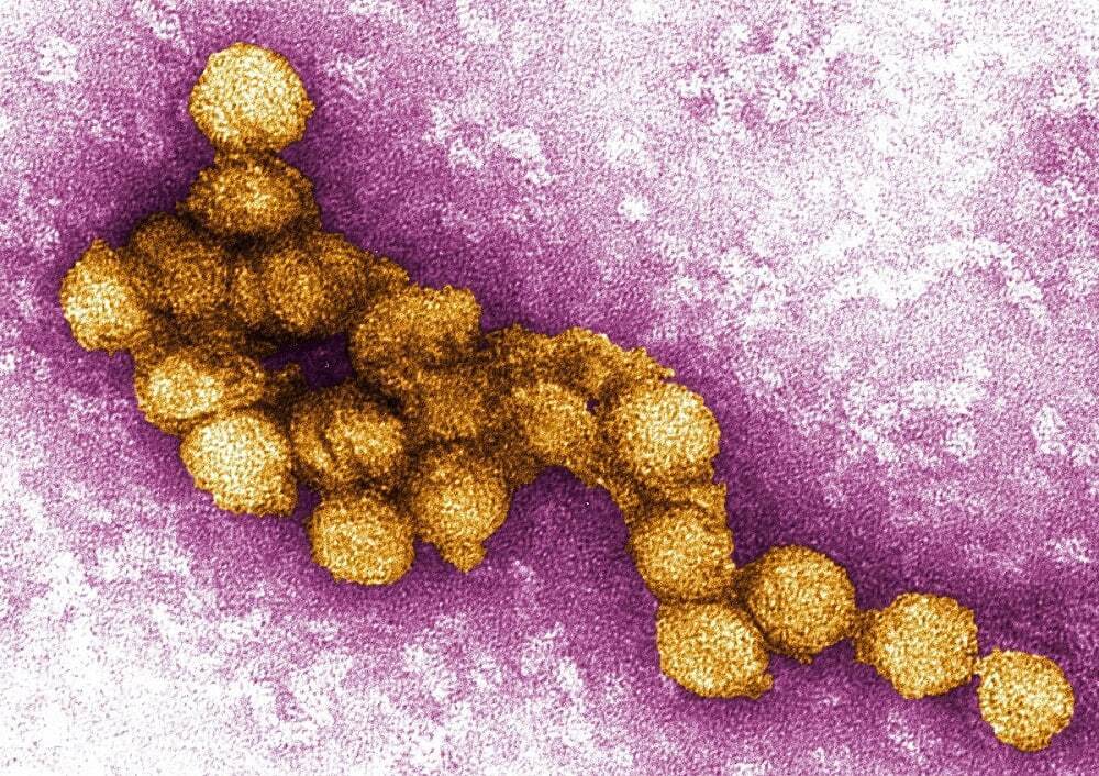ویروس نیل غربی چیست؟ / چگونه مبتلا می‌شویم، چه علائمی دارد و چگونه درمان می‌شود؟ (عصرایران)