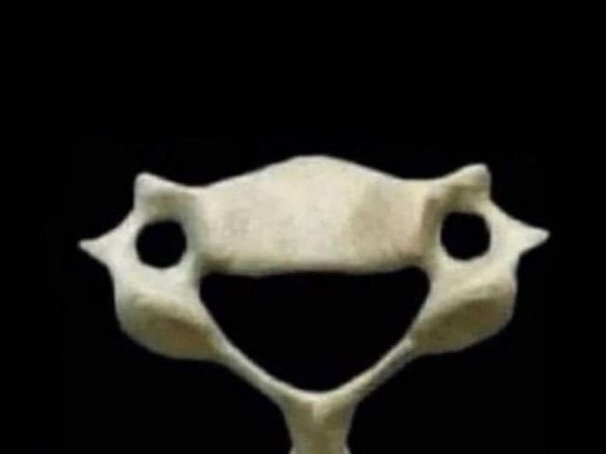 تصویری از مهره ششم گردن انسان که تا به حال ندیده‌اید