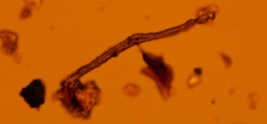 تحقیقات نشان می‌دهند که میکروپلاستیک‌ها حتی در «جفت‌»های انسان‌ها هم وارد شده‌اند (یک پزشک)