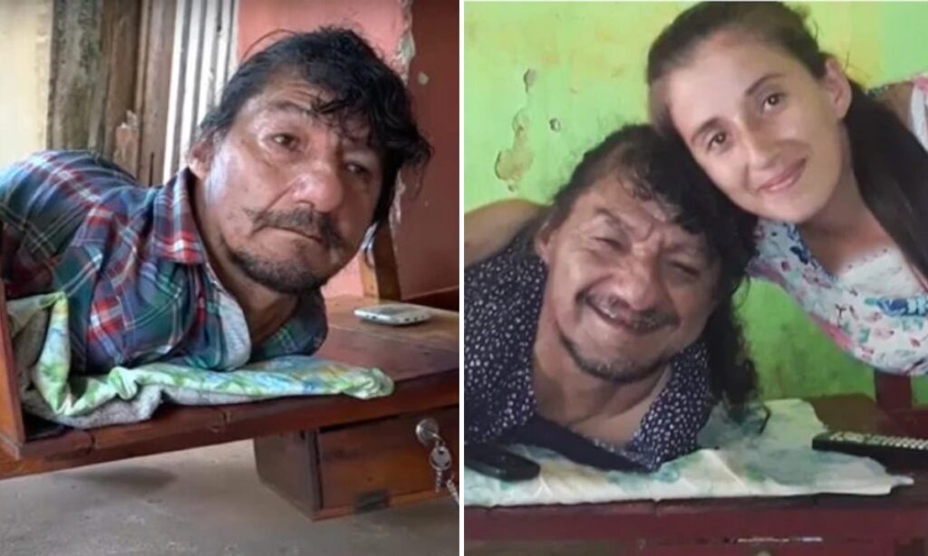 داستان مردی که بدون دست و پا دو دخترش را به تنهایی بزرگ کرد