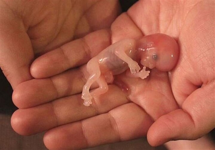 عکسی عجیب از جنین مصنوعی انسان