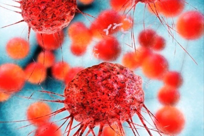 بیومارکر‌ها یا زیست‌شناساگرهای جدید سرطان پروستات برای کمک به بهبود تشخیص و درمان (یک پزشک)