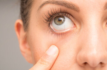 علائم بیماری خشکی چشم را بشناسید