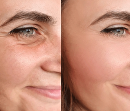 ۵ راهکار طلایی و موثر برای سفت شدن پوست صورت