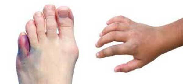 تخفیف درد در شکستگی انگشت پا (نیک صالحی)