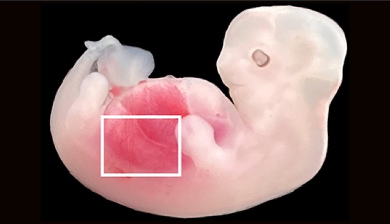 برای نخستین بار درجهان: کلیه‌های انسان با سلول‌های انسانی در جنین خوک رشد پیدا کردند(یک پزشک)