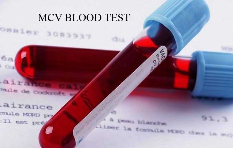 در آزمایش خون mcv چیست؟