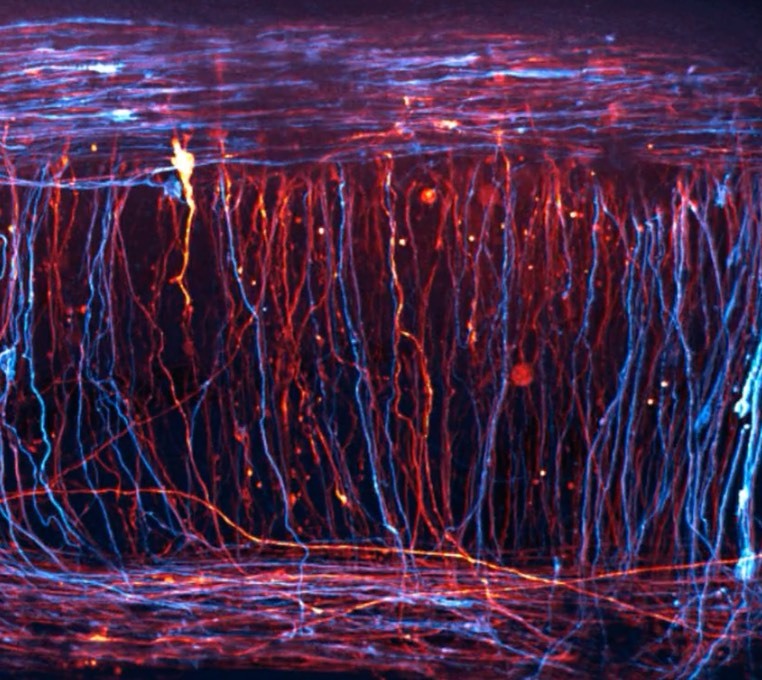 ویدئوی تایم لپس زیبایی از شیوه شکل گرفتن و آرایش سلول‌های عصبی، برنده جایزه عکاسی تصویر کوچک متحرک نیکون شد (یک پزشک)