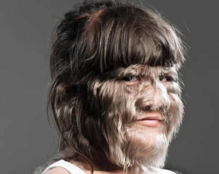 ازدواج دختر گرگ نما؛ تصاویر پرموترین دختر جهان پس از تراشیدن موهای صورتش (بیتوته)