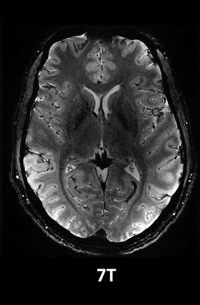 قدرتمندترین دستگاه MRI جهان، اولین اسکن‌های مغزی بسیار دقیق خود را ثبت کرد (یک پزشک)