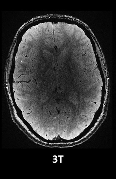 قدرتمندترین دستگاه MRI جهان، اولین اسکن‌های مغزی بسیار دقیق خود را ثبت کرد (یک پزشک)