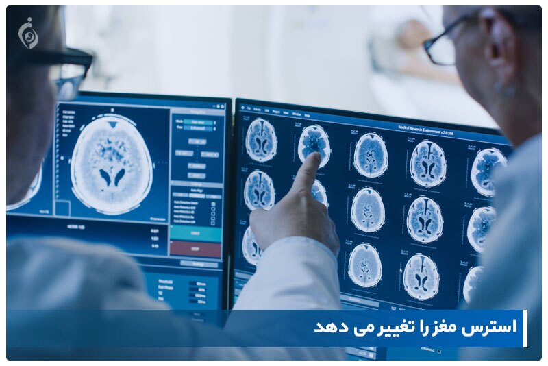 با اسکن مغز fMRI، شش نوع متمایز از افسردگی و اضطراب، شناسایی شد (یک پزشک)