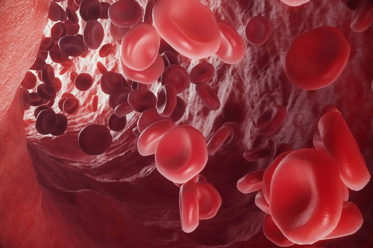 آیا پلاکت خون پایین خطر دارد؟ + روش های درمان آن